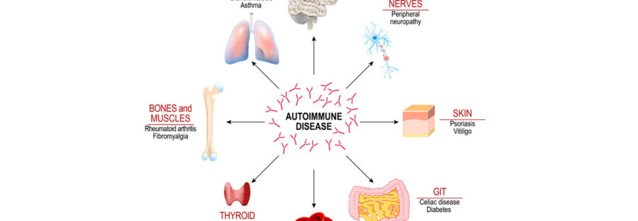 Autoimmune Disease