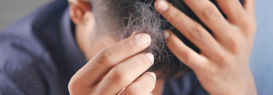 A person holding strands of hair