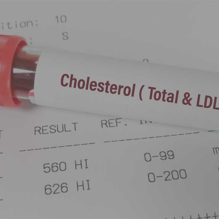 Image hover effect image