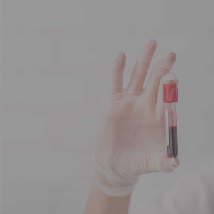 Image hover effect image